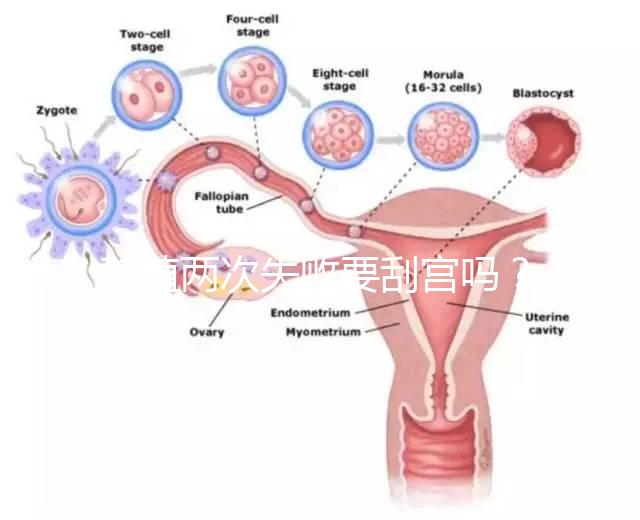 移植兩次失敗要刮宮嗎？做試管前這些問題得知道