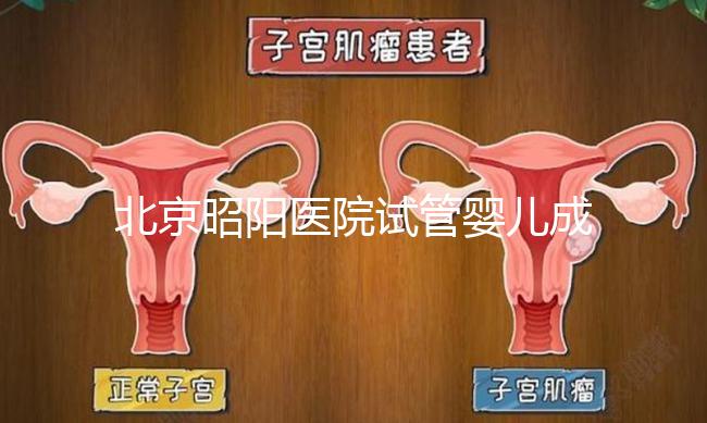 北京昭陽醫院試管嬰兒成功率？生殖醫院醫生排名推薦
