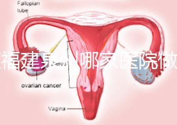 在福建泉州哪家醫院做試管嬰兒好