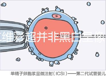 二維彩超并非黑白呈像,通過檢查還能看清胎兒五官