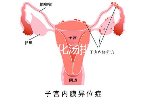 產后喝生化湯排惡露會使寶寶拉肚子？醫生：時間沒用對
