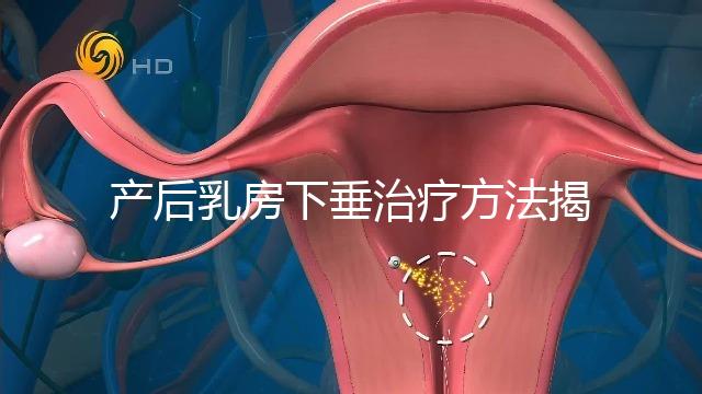 產(chǎn)后乳房下垂治療方法揭秘，按摩手法再好也沒提前預(yù)防有用