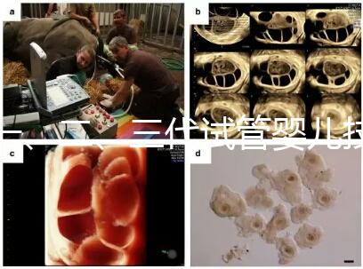 一、二、三代試管嬰兒技術(shù)的區(qū)別,看完你就知道了!