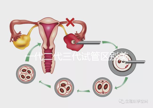 一代二代三代試管區(qū)別美琳達(dá)(一代二代三代試管區(qū)別及價格)