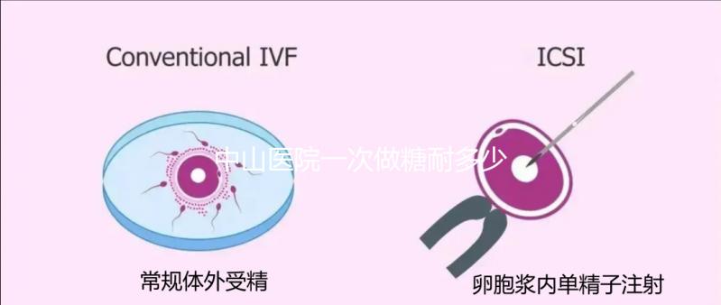 中山醫(yī)院一次做糖耐多少錢？你想預(yù)約專家嗎？