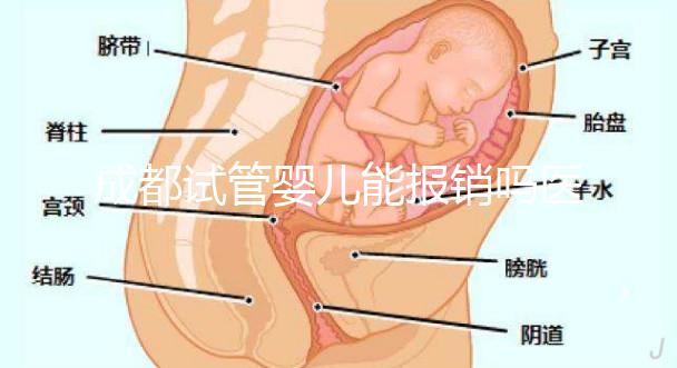 成都試管嬰兒能報銷嗎醫保？政策解讀