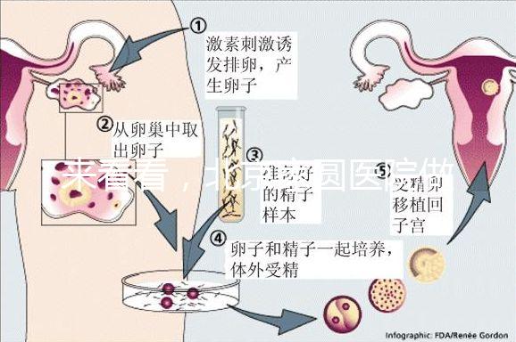 來看看，北京家圓醫(yī)院做三代試管費(fèi)用總共多少？
