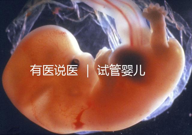 有醫說醫 ｜ 試管嬰兒技術不能避免宮外孕，“三孩”時代警惕宮外孕發生率增加