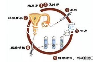 泰國三代試管價格變動,2025年最新費用行情一覽
