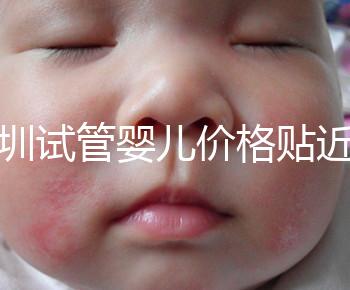 深圳試管嬰兒價(jià)格貼近百姓！三代試管只需8