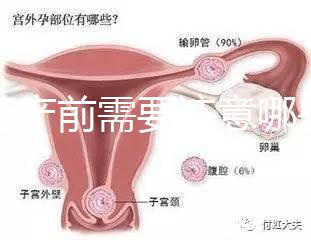 孕婦產前需要注意哪些事項？