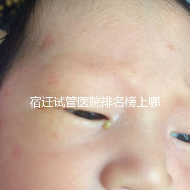 宿遷試管醫院排名榜上哪家好，不造助孕成功率和費用別亂選