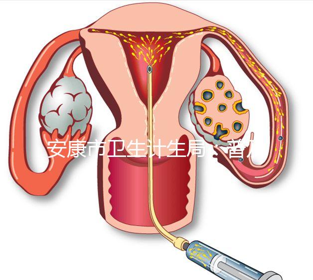 安康市衛(wèi)生計(jì)生局:普及優(yōu)生優(yōu)育五項(xiàng)檢查相關(guān)知識