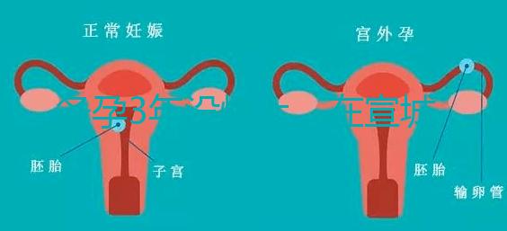 備孕3年沒懷上，在宣城可以做試管嬰兒嗎？