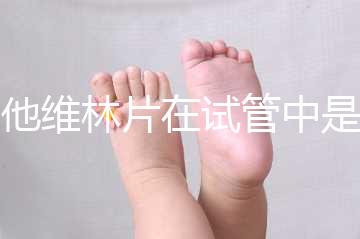 屈他維林片在試管中是否有副作用，導(dǎo)致胎停不是空穴來風(fēng)