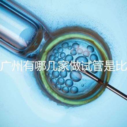 廣州有哪幾家做試管是比較靠譜的，最近有打算？