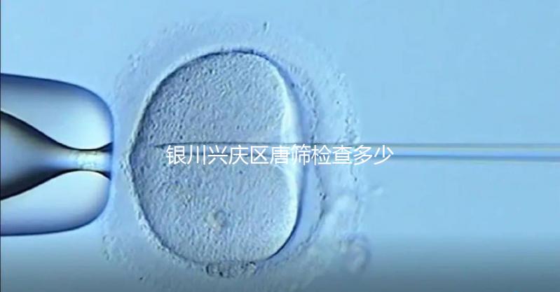 銀川興慶區(qū)唐篩檢查多少錢取決于情況，2024年國(guó)家免費(fèi)限額