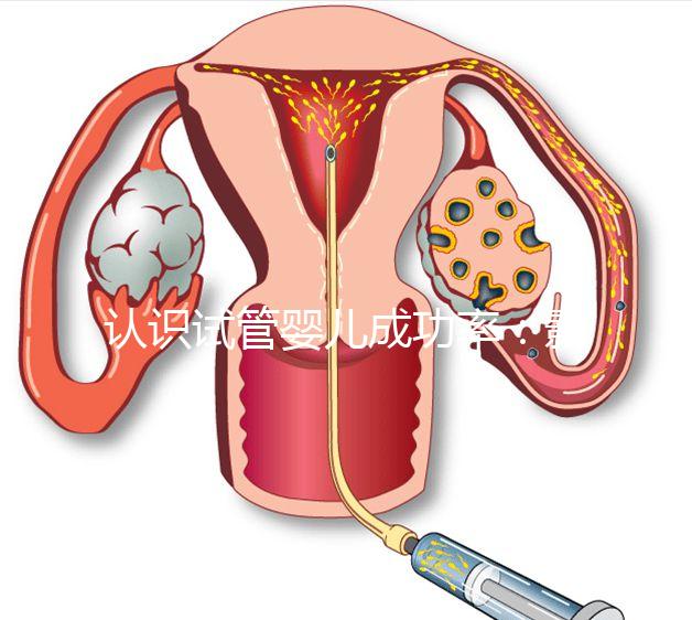 認(rèn)識試管嬰兒成功率：影響胚胎著床的胚胎因素