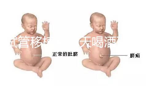 試管移植前幾天喝酒了有影響嗎？想要懷孕得管住嘴！