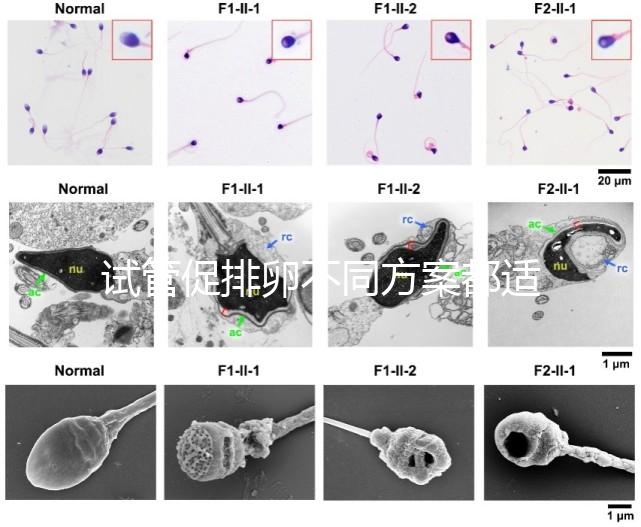 試管促排卵不同方案都適合哪些人？如何監(jiān)測(cè)排卵？