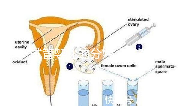 試管嬰兒的分娩方式有哪些？能否自然分娩取決于情況