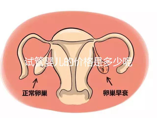 試管嬰兒的價格是多少呢?
