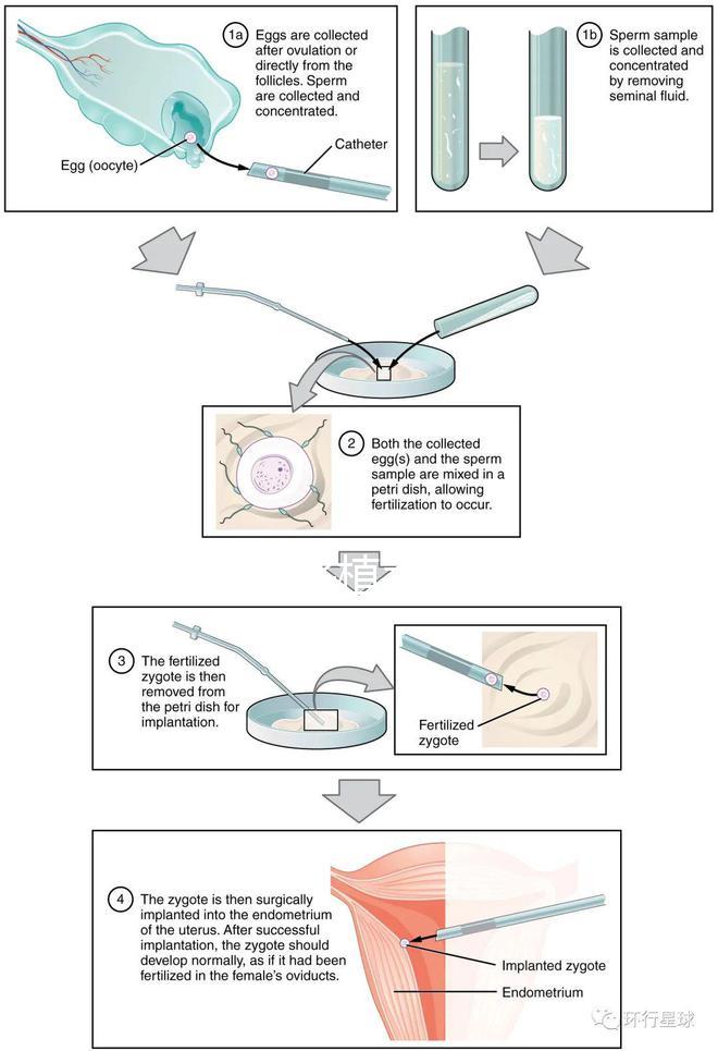 試管嬰兒移植手術(shù)(試管嬰兒移植手術(shù)需要多長(zhǎng)時(shí)間)