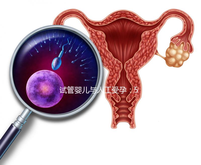試管嬰兒與人工受孕:5個(gè)關(guān)鍵區(qū)別