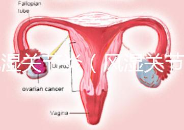 風濕關節(jié)炎（風濕關節(jié)炎的癥狀有哪些）