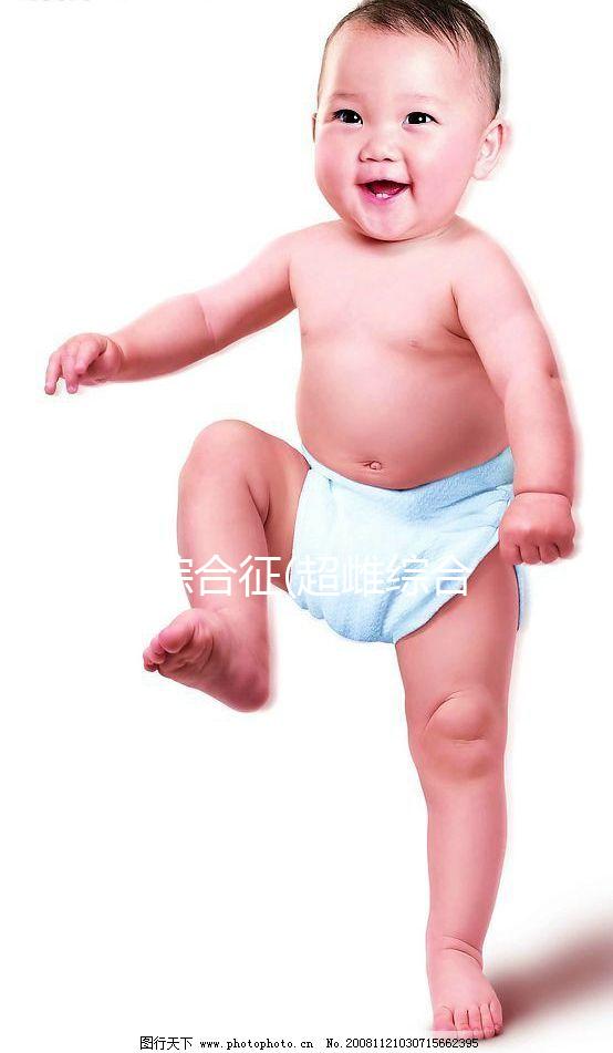 XXX綜合征(超雌綜合征)是什么？一種性染色體異常的疾病